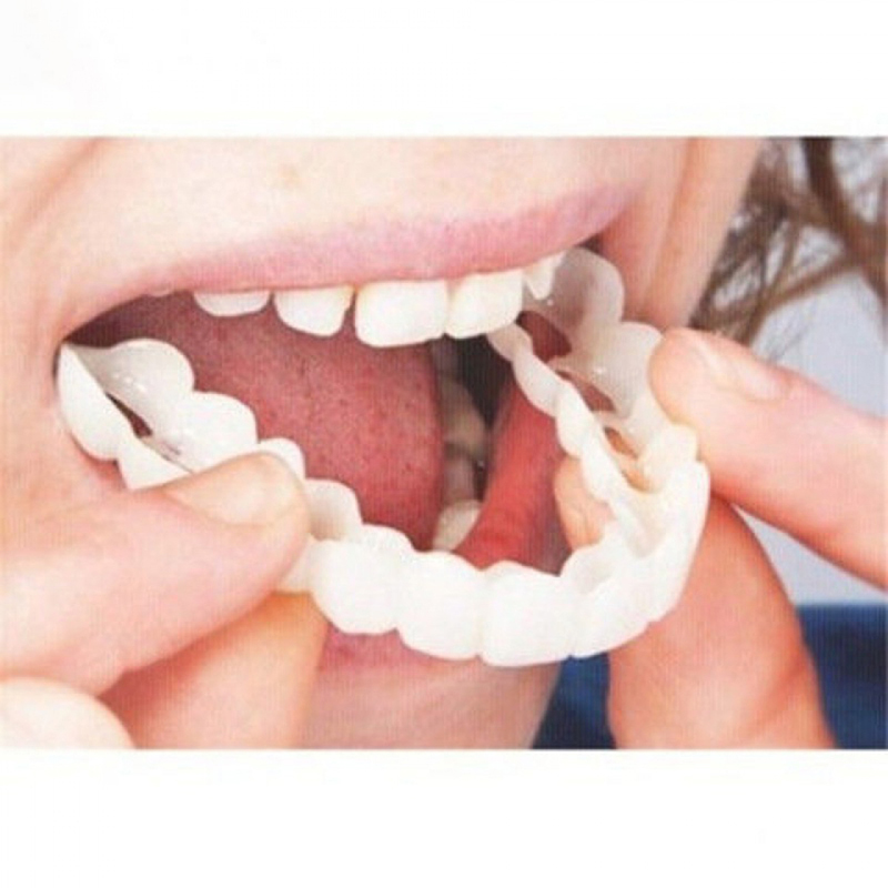 Teeth Whitening For Braces - 1 Nha Khoa Trên Và Giả