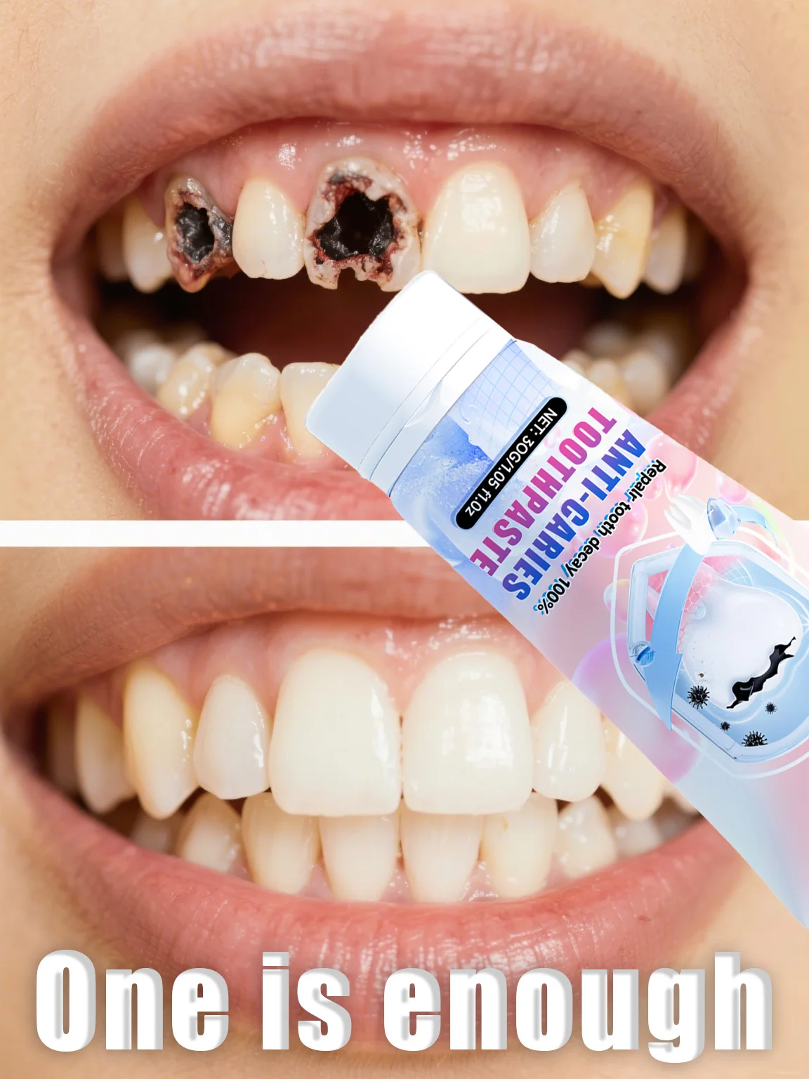 Teeth Whitening Yellow Teeth - ⁹⁹% ᵒᶠ ᵖᵉᵒᵖˡᵉ ʳᵉᵖᵘʳᶜʰᵃˢᵉ ᵗᵒ ʳᵉᵖᵃⁱʳ