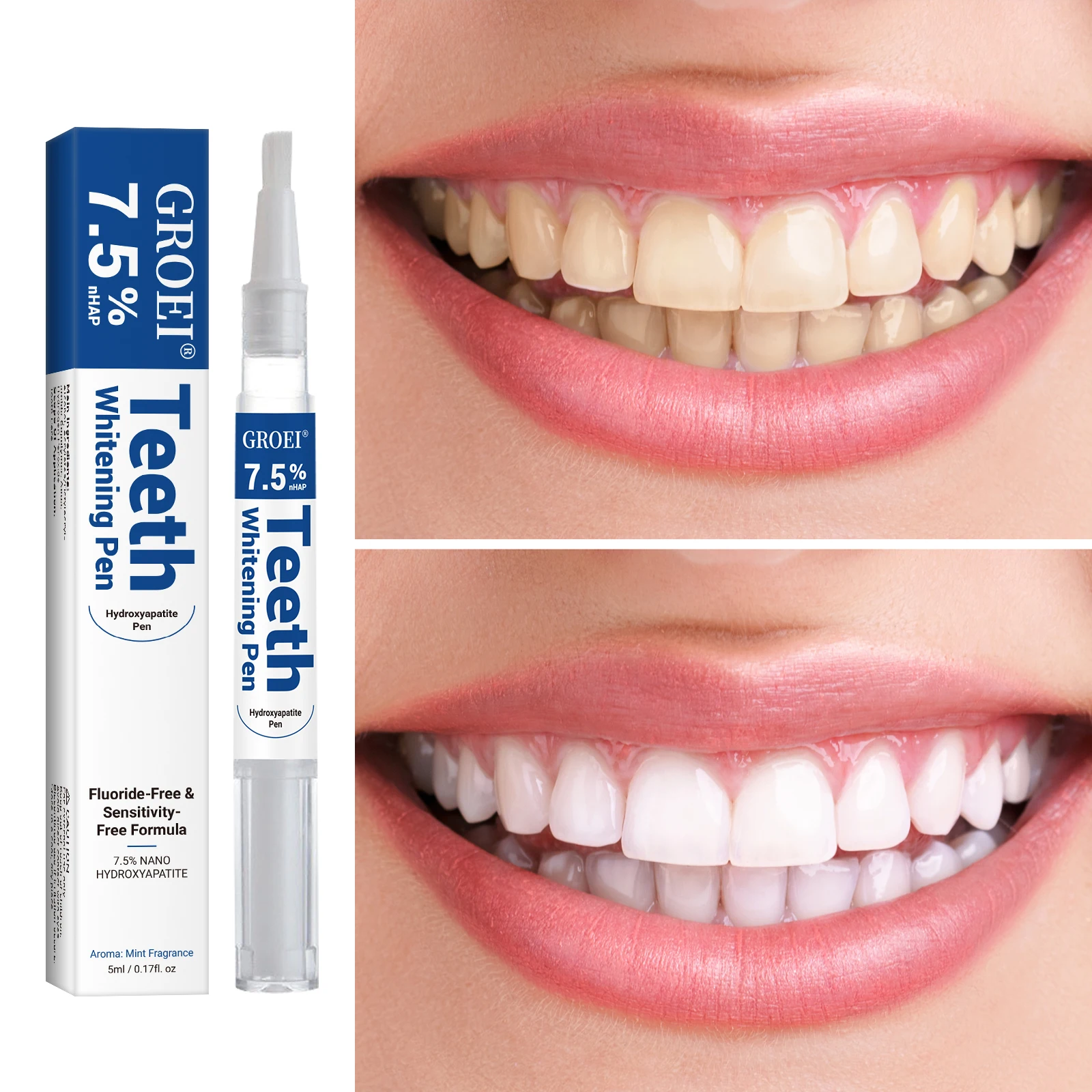 Hydroxyapatite Tooth Whitening - đánh giá và giá Teeth Whitening Q&M