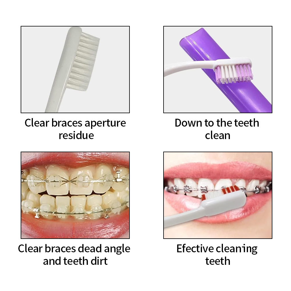 8Pcs/set Orthodontic Dental Ca - đánh giá và giá Teeth Whitening For Braces