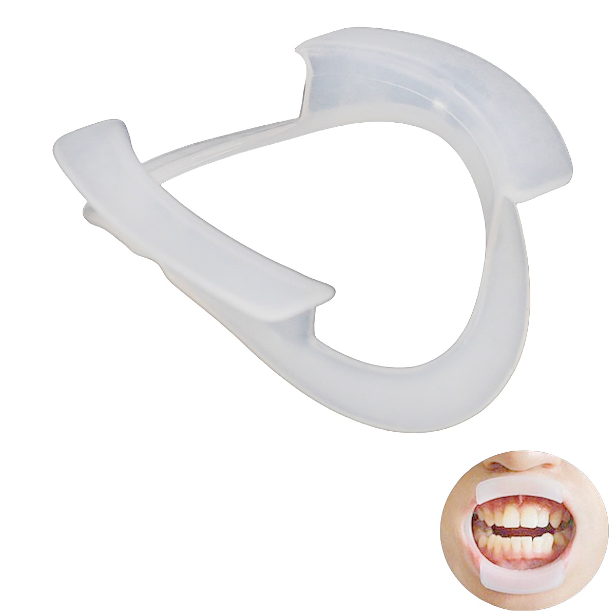 100pcs/bag Dental O-Shape Intr - đánh giá và giá Teeth Whitening For Braces