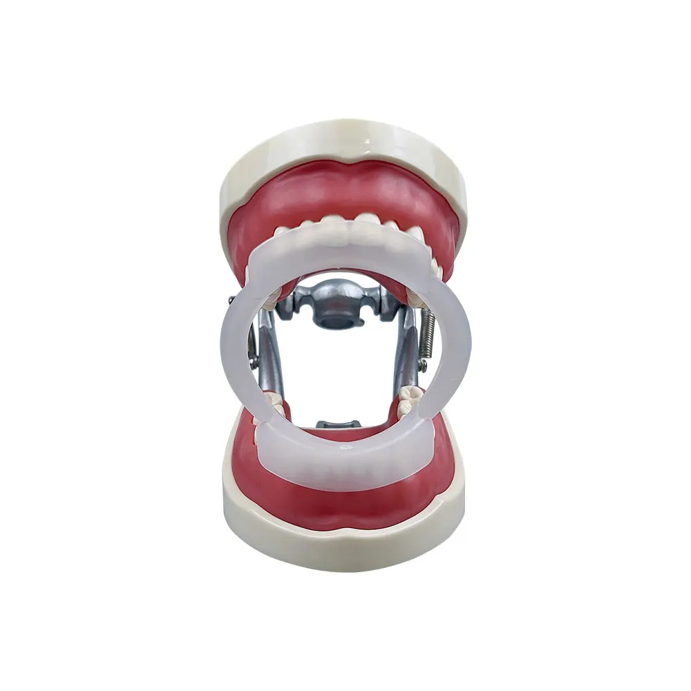 100pcs/bag Dental O-Shape Intr - đánh giá và giá Teeth Whitening For Braces