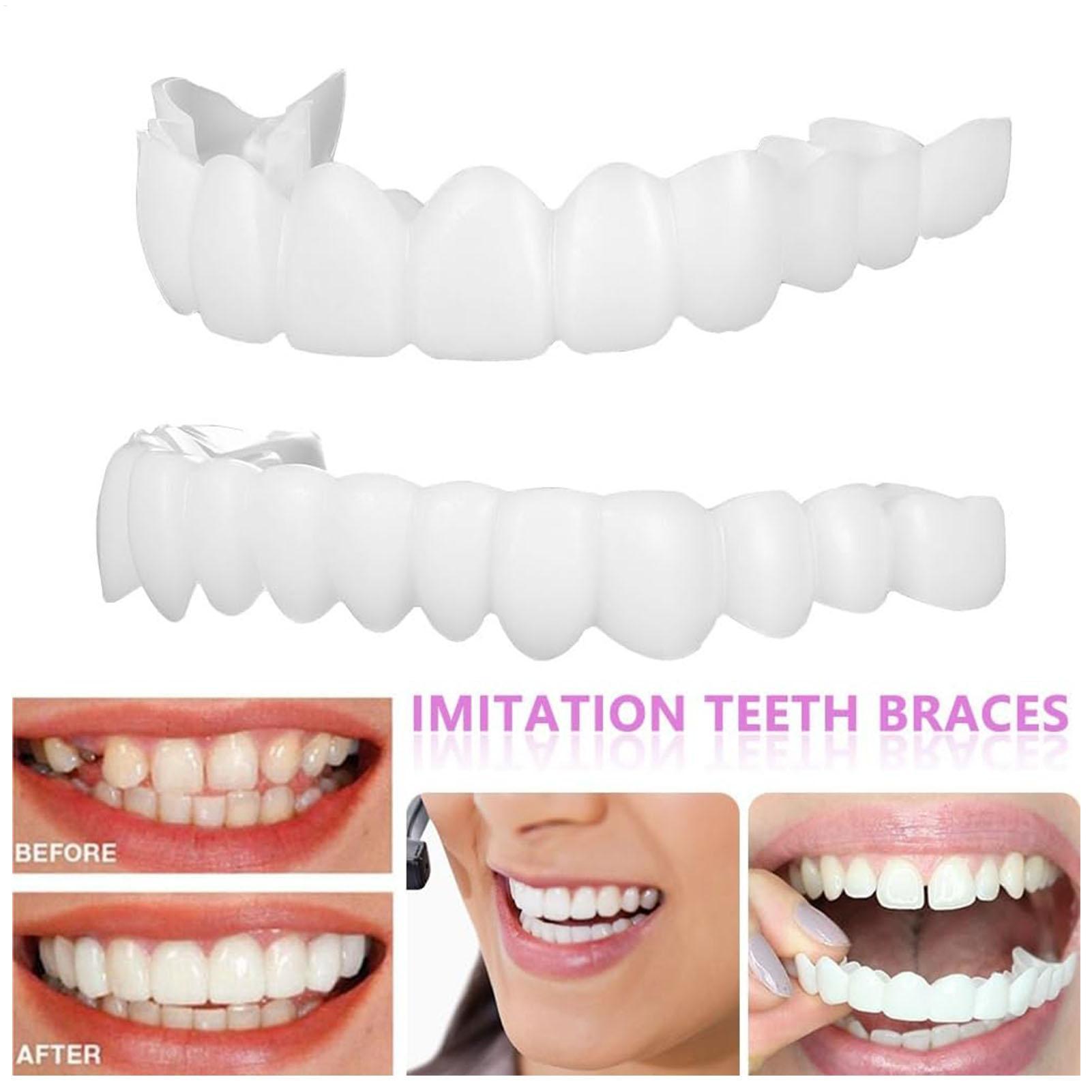 Dental Upper Lower Fake Teeth  - đánh giá và giá Teeth Whitening For Braces