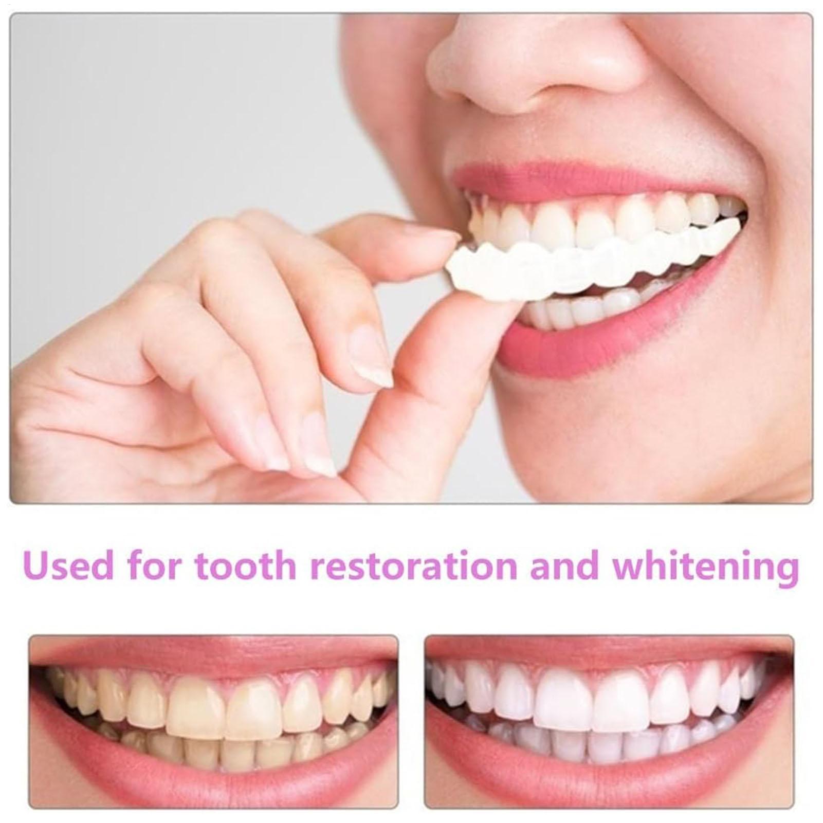 Dental Upper Lower Fake Teeth  - đánh giá và giá Teeth Whitening For Braces