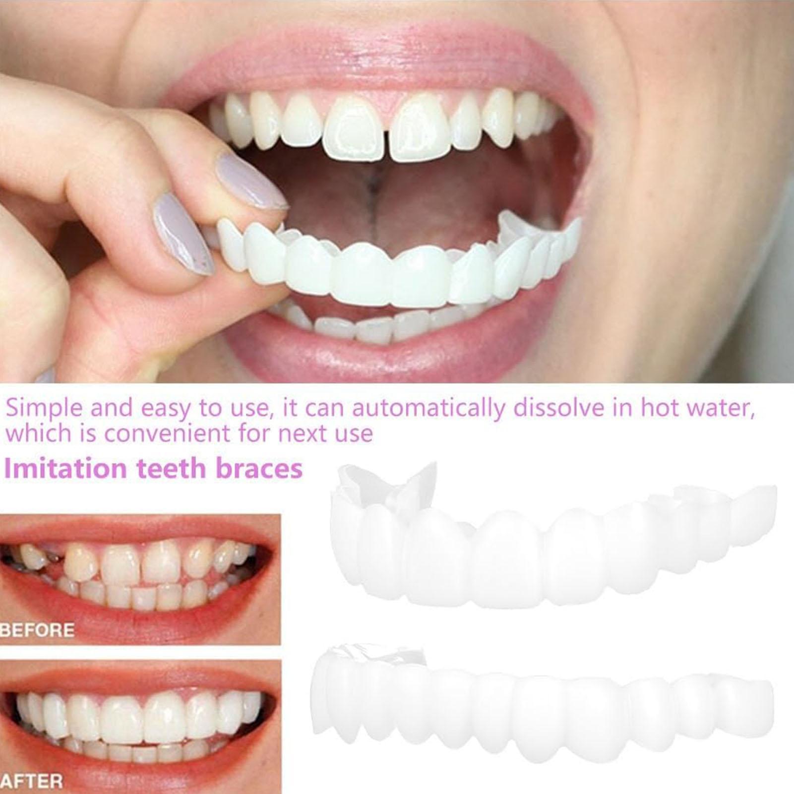 Dental Upper Lower Fake Teeth  - đánh giá và giá Teeth Whitening For Braces