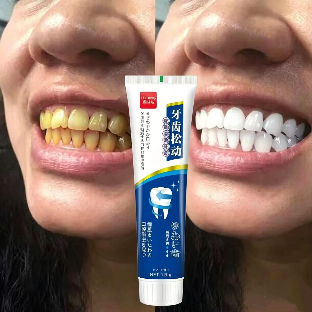 Fix Loose Teeth Japanese Impor - đánh giá và giá Teeth Whitening Japan
