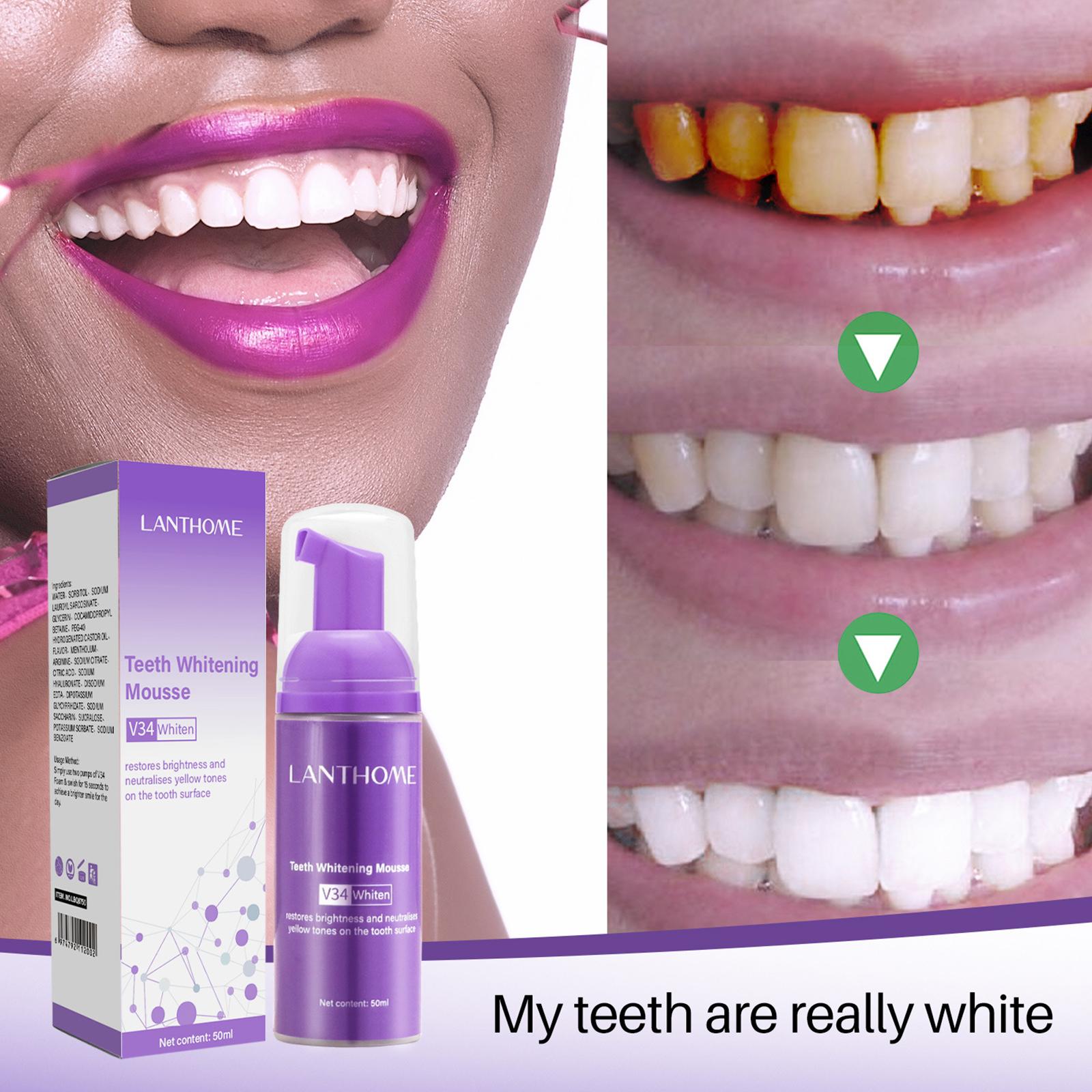 V34 Mousse Teeth Cleaning Toot - đánh giá và giá Teeth Whitening Mousse