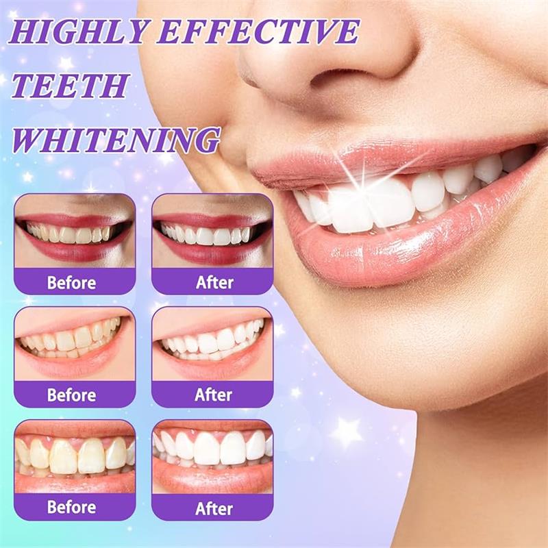 9D Purple Teeth Whitening Toot - đánh giá và giá Teeth Whitening Mousse