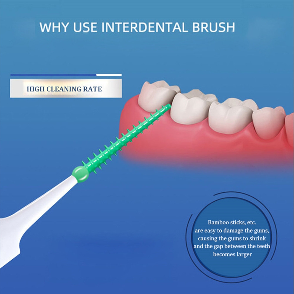 40~150PCS Silicone Interdental - đánh giá và giá Teeth Whitening For Braces
