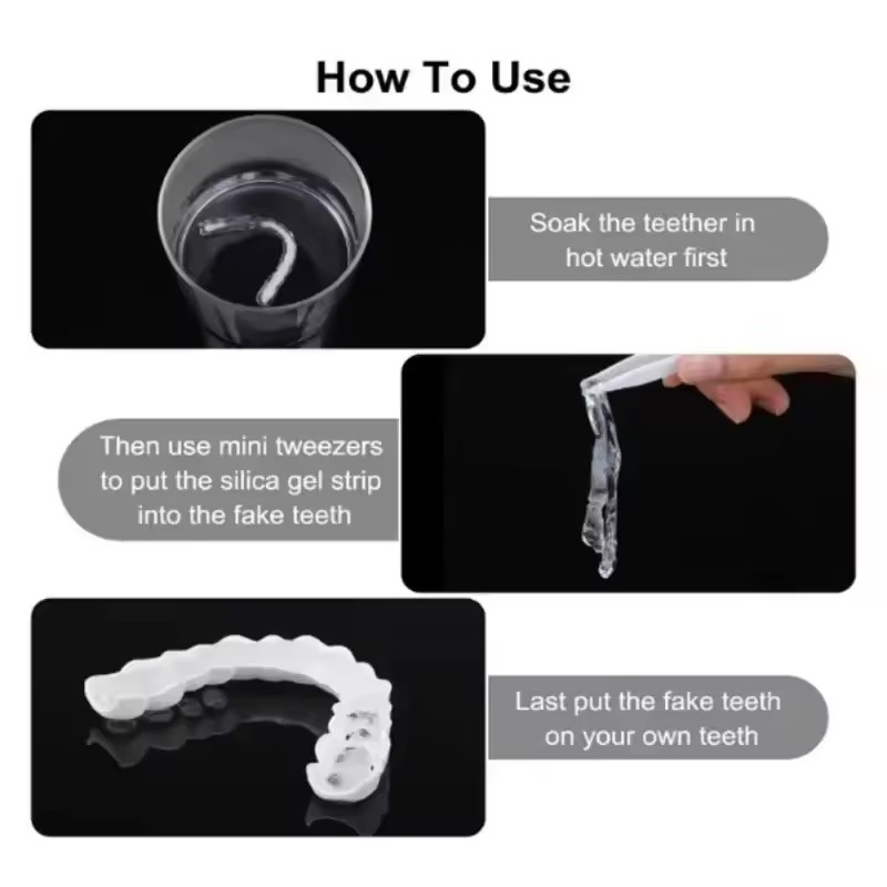 Teeth Veneers Whitening Dentur - đánh giá và giá Teeth Whitening For Braces