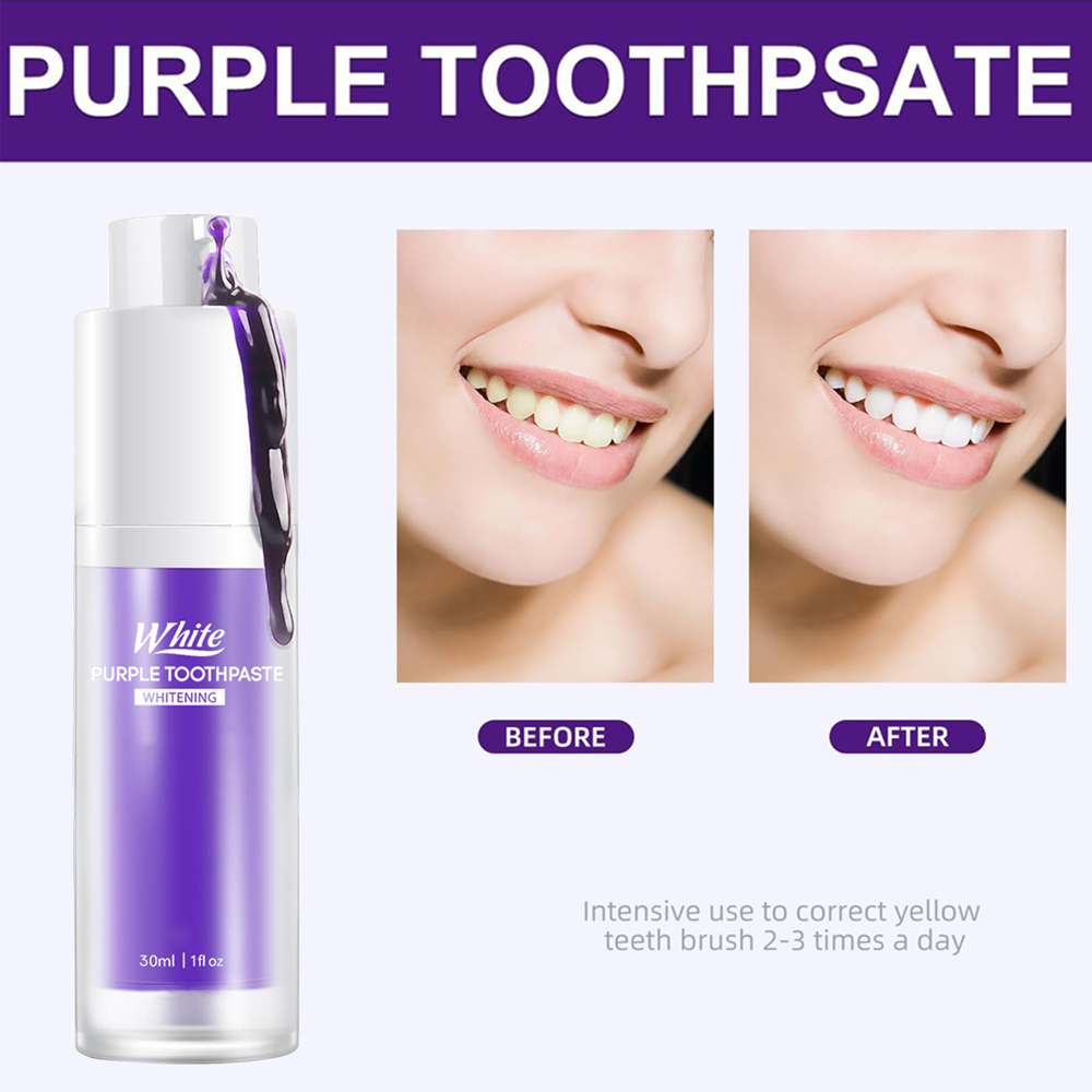 Purple Whitening Toothpaste 30 - đánh giá và giá Teeth Whitening Treatment