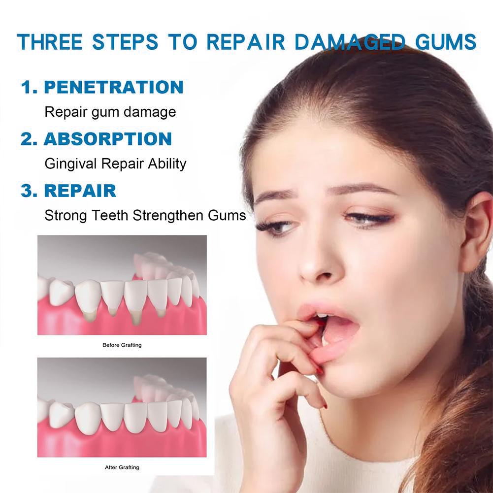 Dental Care Toothpaste Natural - đánh giá và giá Teeth Whitening Treatment