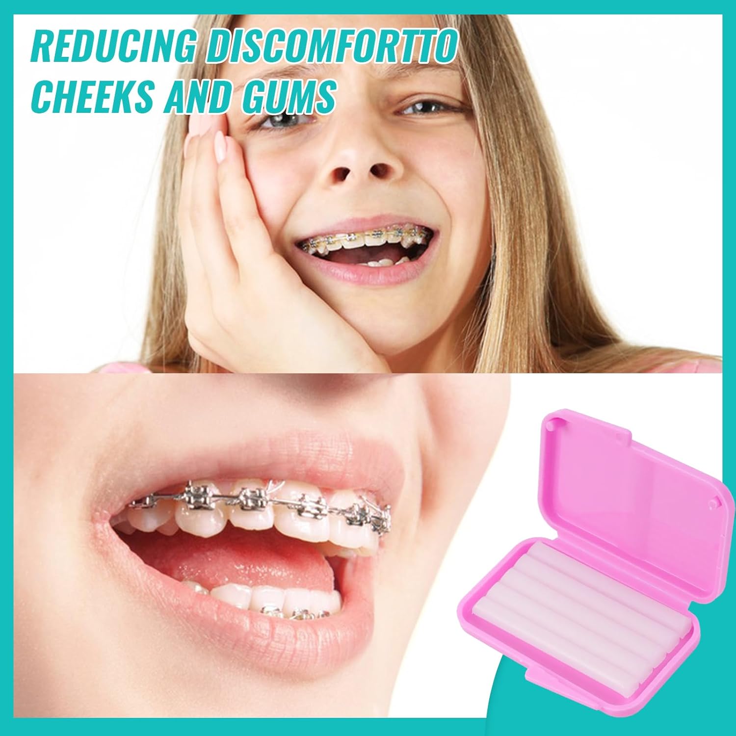 10box Dental Orthodontic Relie - đánh giá và giá Teeth Whitening For Braces