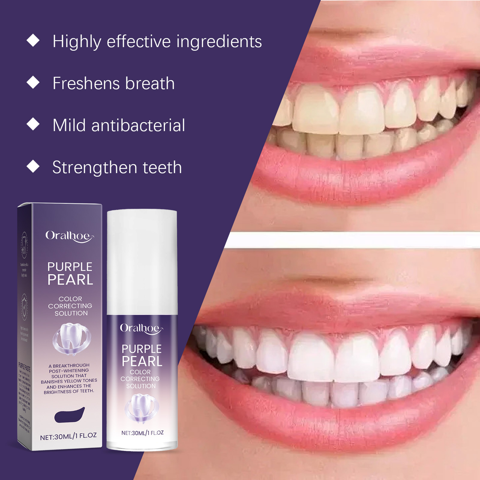 2026 New Purple Teeth Whitenin - đánh giá và giá Teeth Whitening Mousse