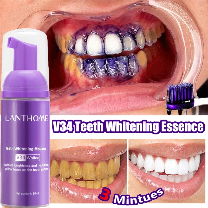 V34 Teeth Whitening Mousse Too - đánh giá và giá Teeth Whitening Mousse