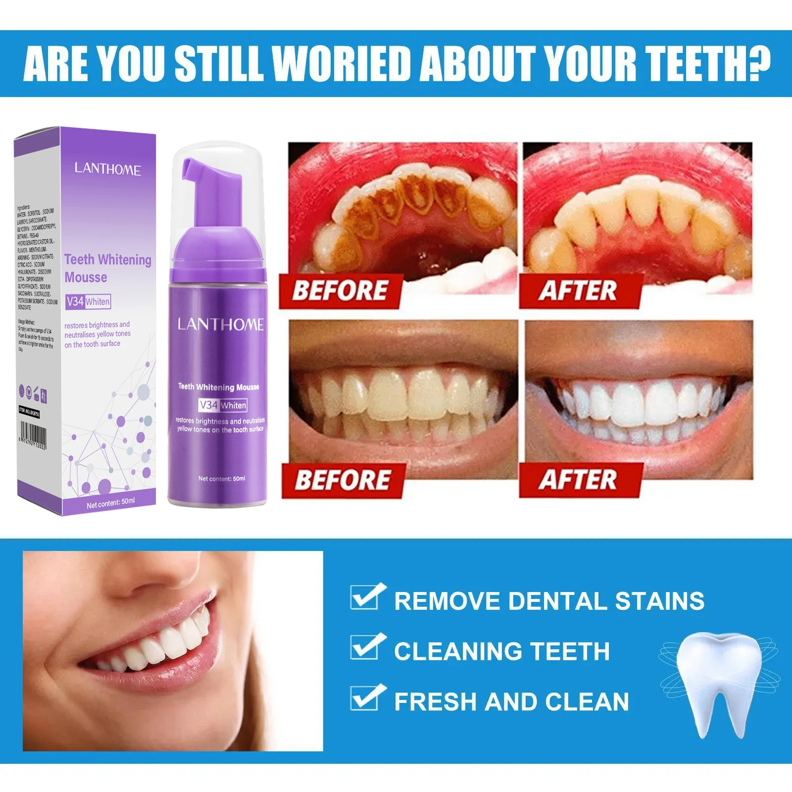 V34 Teeth Whitening Mousse Too - đánh giá và giá Teeth Whitening Mousse