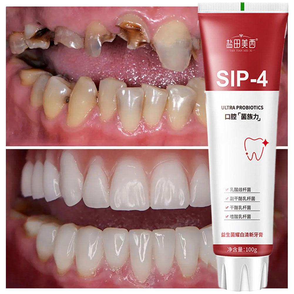 100g Sip-4 Probiotic Whitening - đánh giá và giá Teeth Whitening Yellow Teeth