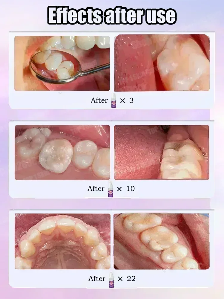 Hot sales Best-selling, Scient - đánh giá và giá Teeth Whitening Treatment