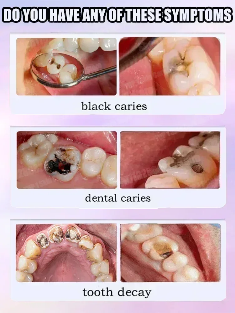 Hot sales Best-selling, Scient - đánh giá và giá Teeth Whitening Treatment