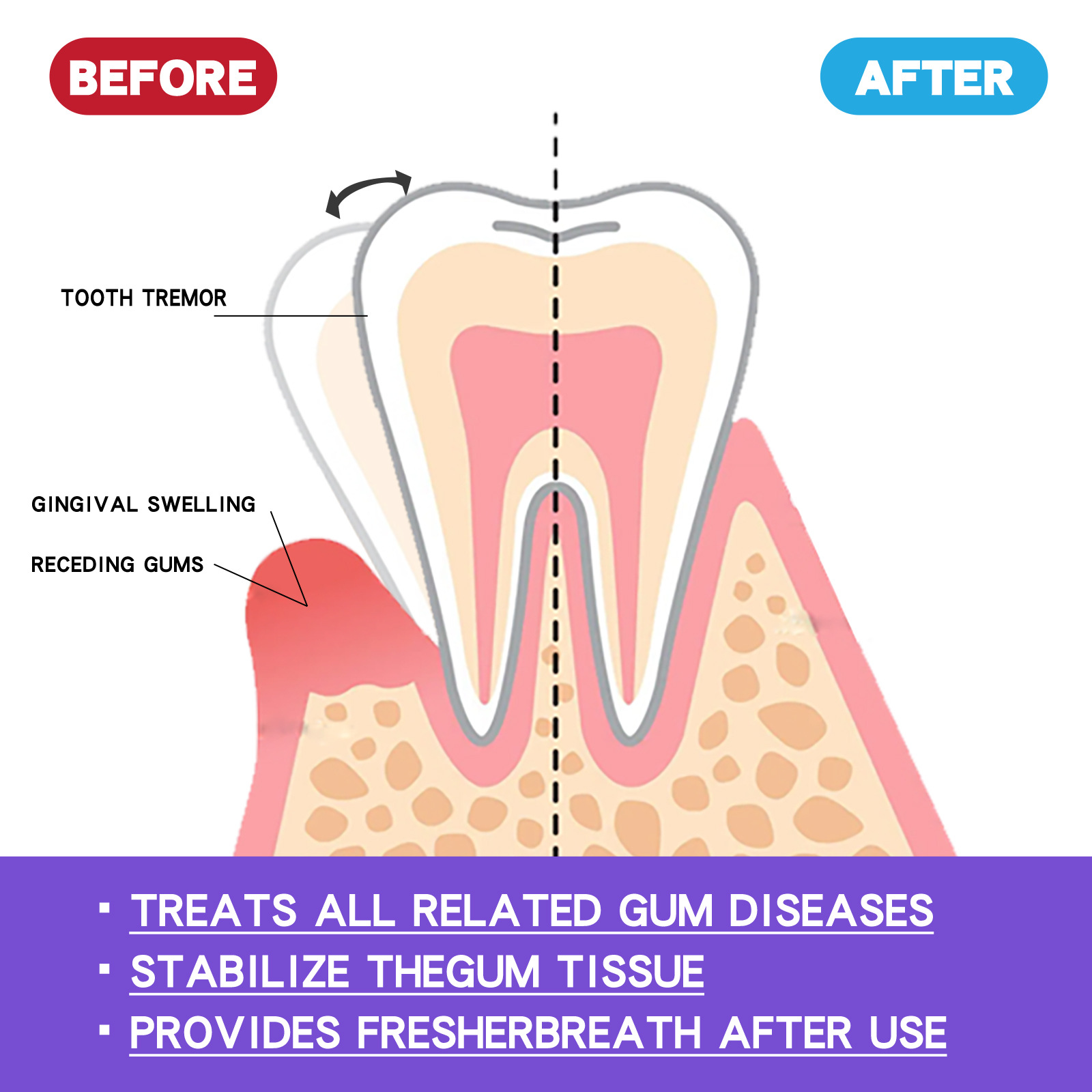 60ml Teeth Whitening Mousse V3 - đánh giá và giá Teeth Whitening Mousse