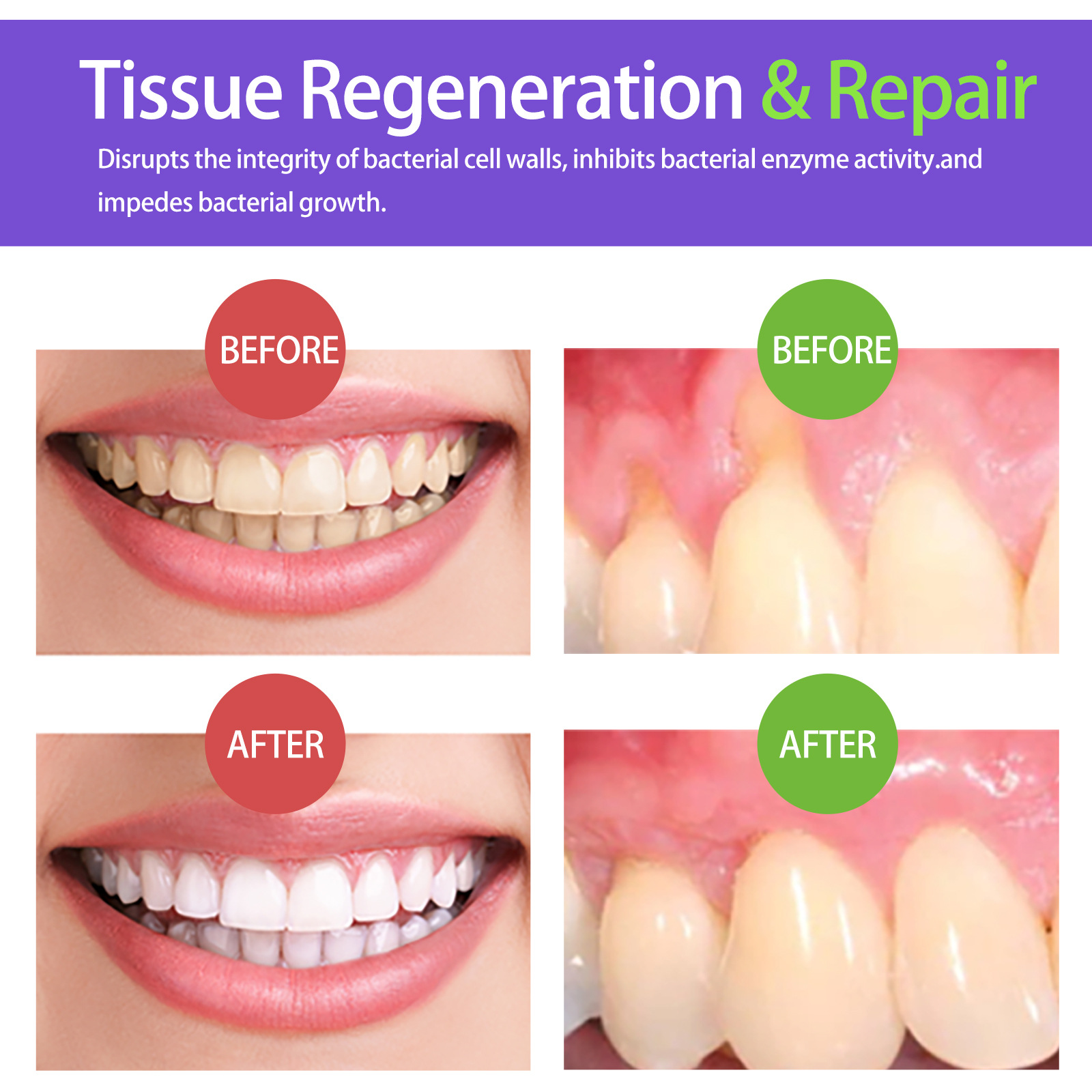 60ml Teeth Whitening Mousse V3 - đánh giá và giá Teeth Whitening Mousse