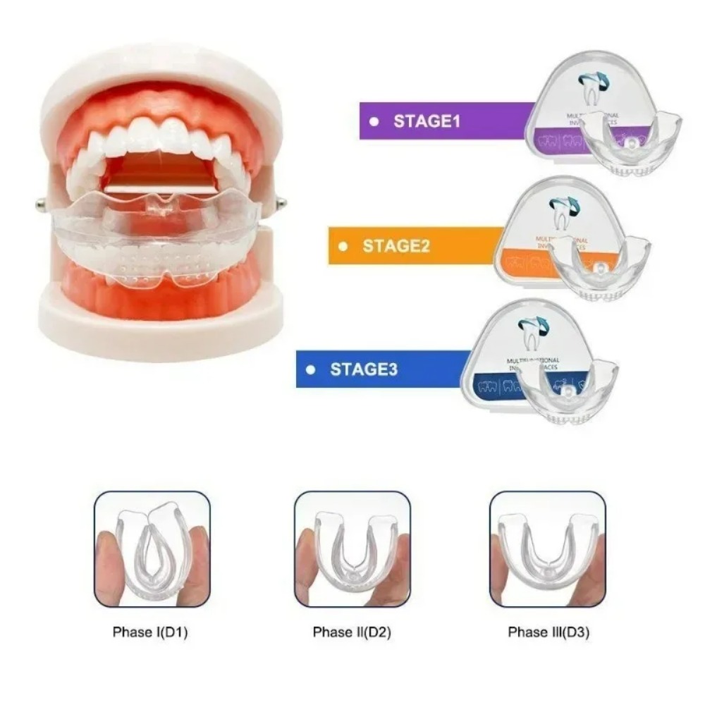 Orthodontic Brace Straightener - đánh giá và giá Teeth Whitening For Braces