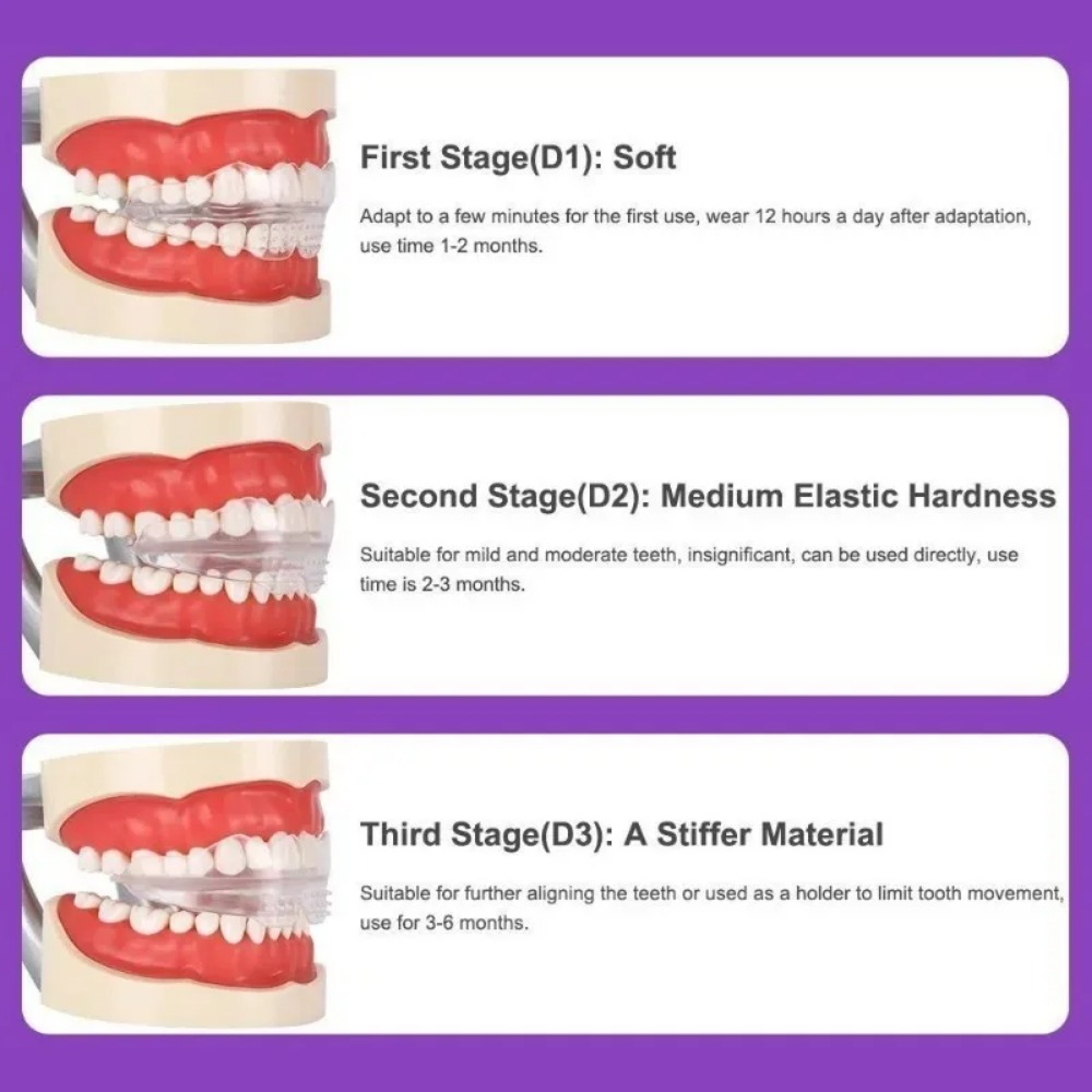 Orthodontic Brace Straightener - đánh giá và giá Teeth Whitening For Braces