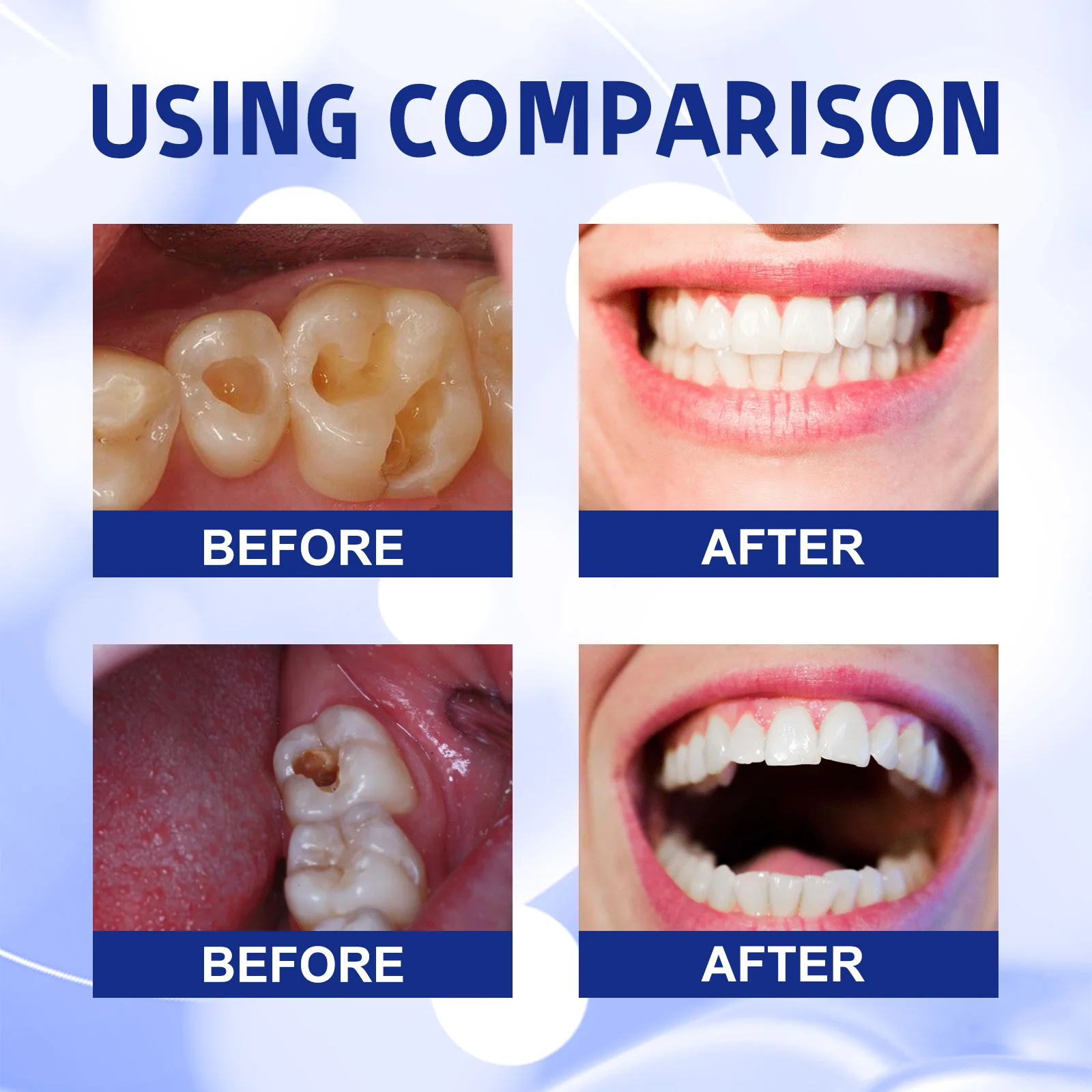 ⁹⁹% ᵒᶠ ᵖᵉᵒᵖˡᵉ ʳᵉᵖᵘʳᶜʰᵃˢᵉ ᵗᵒ ʳᵉ - đánh giá và giá Teeth Whitening Yellow Teeth